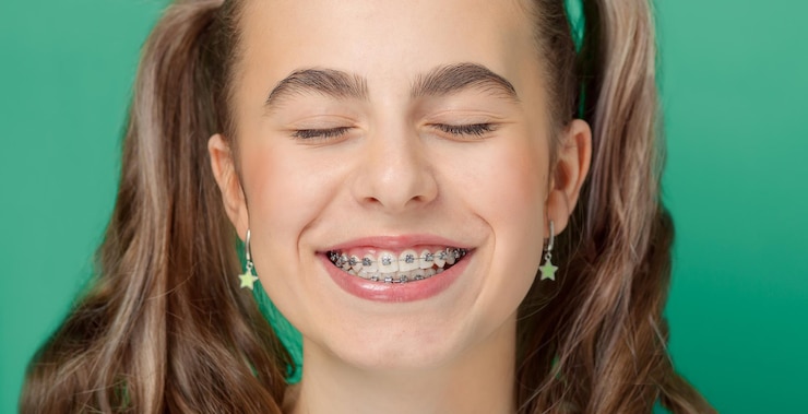 metal braces
metal braces cost singapore
metal braces singapore
cheapest metal braces in singapore