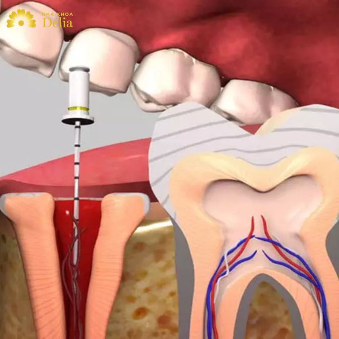 AD_4nXdOv6afJSjaZkRLpd7PzSVdji7Uma9XJEE0vo88Hw5oEkESW6C83wM3kQtoTpqnnSjp5CFi47fRSvNBOQoSa_aTyupBvM7E2A9SDM5dVypCnS9TtcL3BoNDDdOTN-lt7cXPrhdr9Q