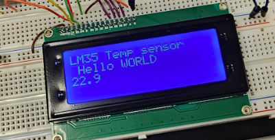 LCD screen displaying "Hello World"