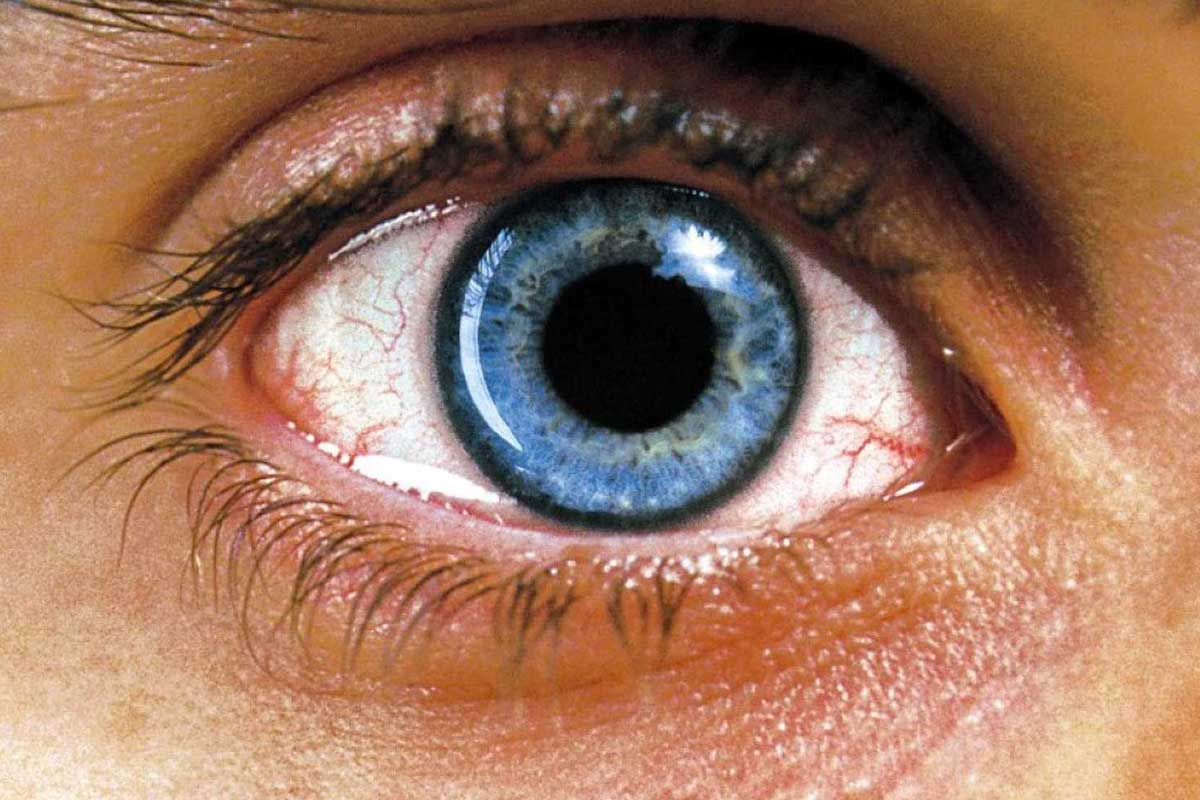 Primer plano de un ojo azul con detalles visibles en el iris y venas enrojecidas en la esclerótica. La imagen resalta el contraste entre el color intenso del iris y las texturas de la piel alrededor del ojo.