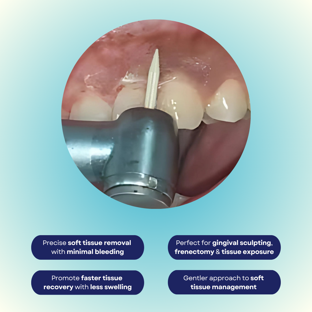 Mr. Bur Soft Tissue Trimming Ceramic Powder Bur FG for precise soft tissue sculpting, flap conditioning, and gingival reshaping with enhanced healing and reduced bleeding.