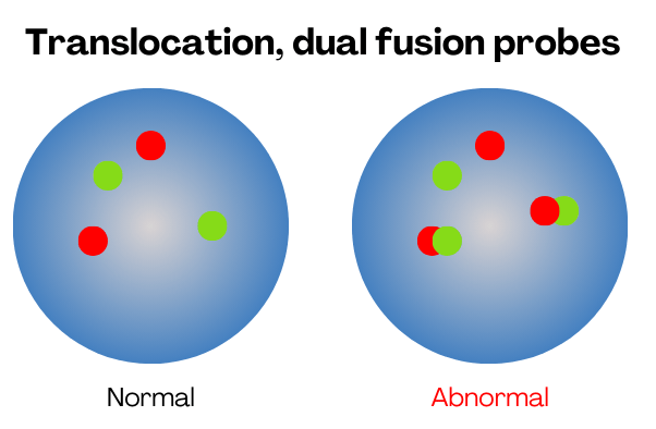 Illustration of FISH translocation or dual gene fusion probes. 