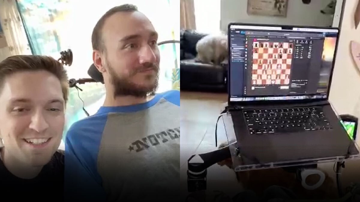 Neuralink'in İkinci Beyin İmplantı: İlkinden Daha Başarılı Olacak mı?