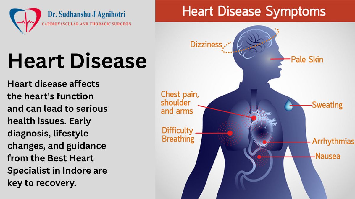Heart Disease - Dr Sudhanshu J Agnihotri - Best Heart Specialist In Indore
