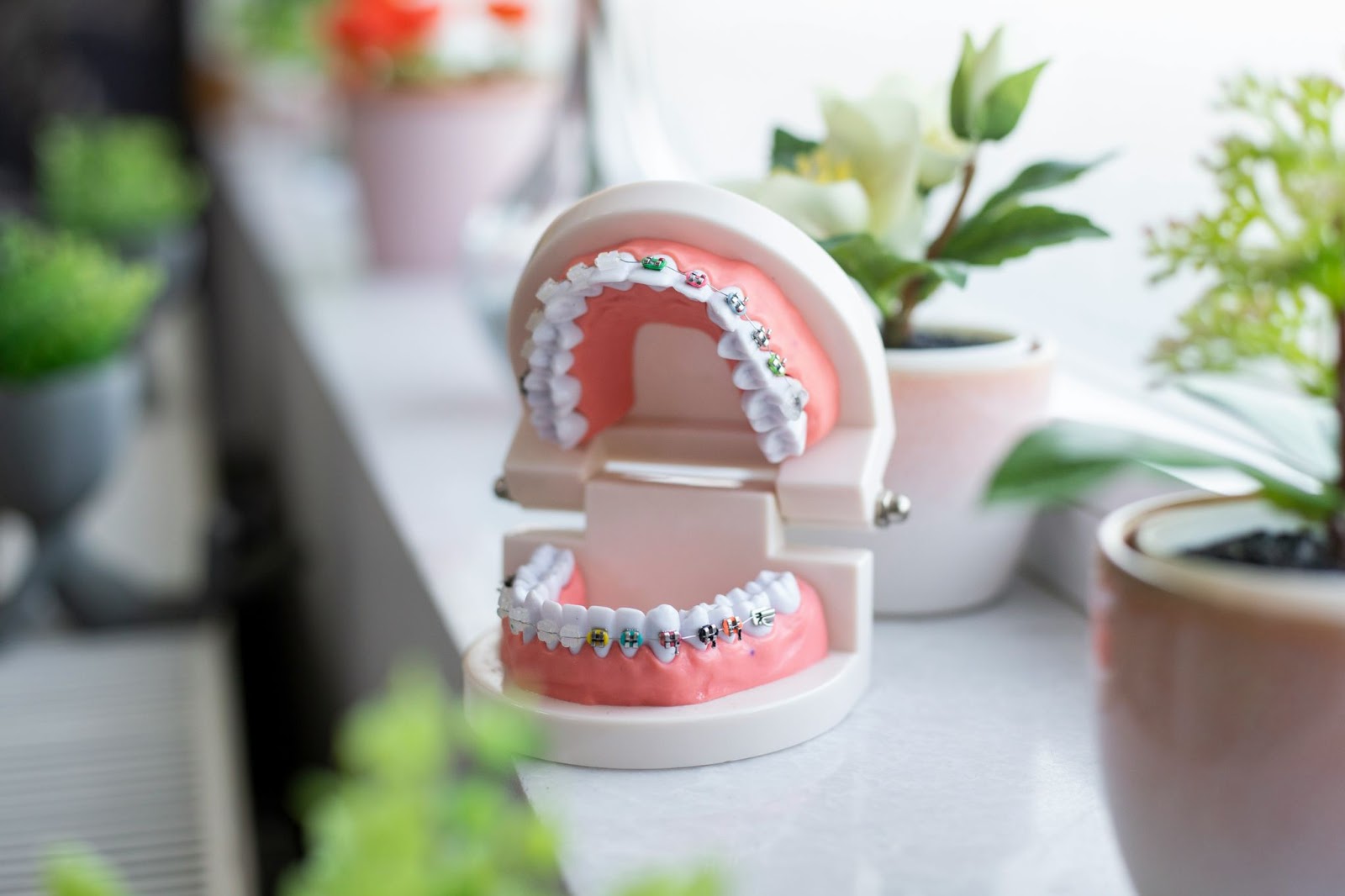 Colorful braces model displayed around plants.
