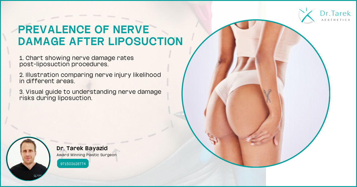 Can Liposuction Cause Nerve Damage