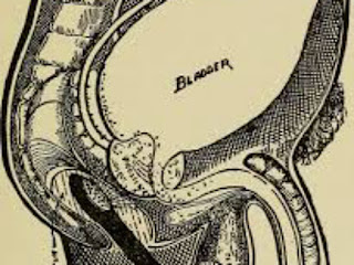 Prostatitis - Disease: - Symptoms, - Treatment - and - Prevention