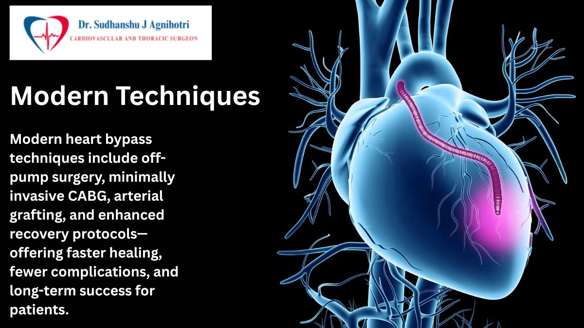 Heart Bypass Surgery by Dr Sudhanshu J Agnihotri a Leading Best Cardiac Surgeon In Indore