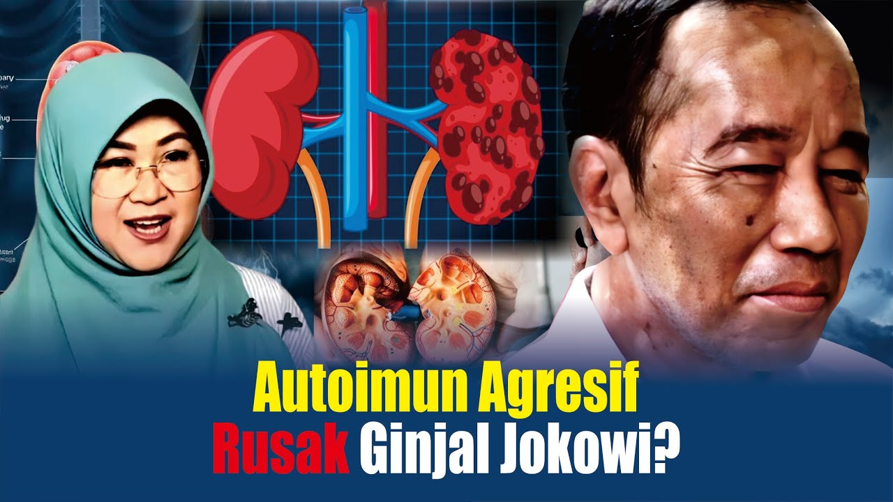 Dokter Tifa Soroti Jalan Tertatih Jokowi sebagai Sinyal Serius Gangguan  Autoimun