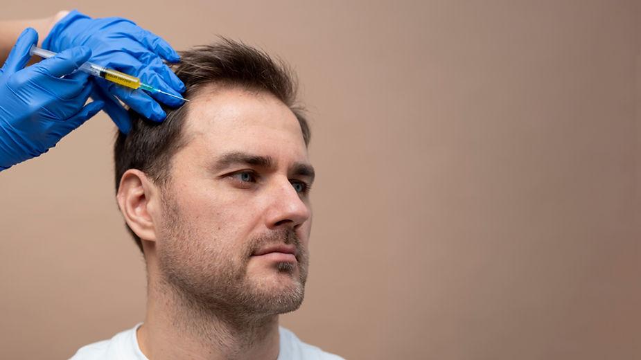 A surgeon is injecting syringe on patient scalp