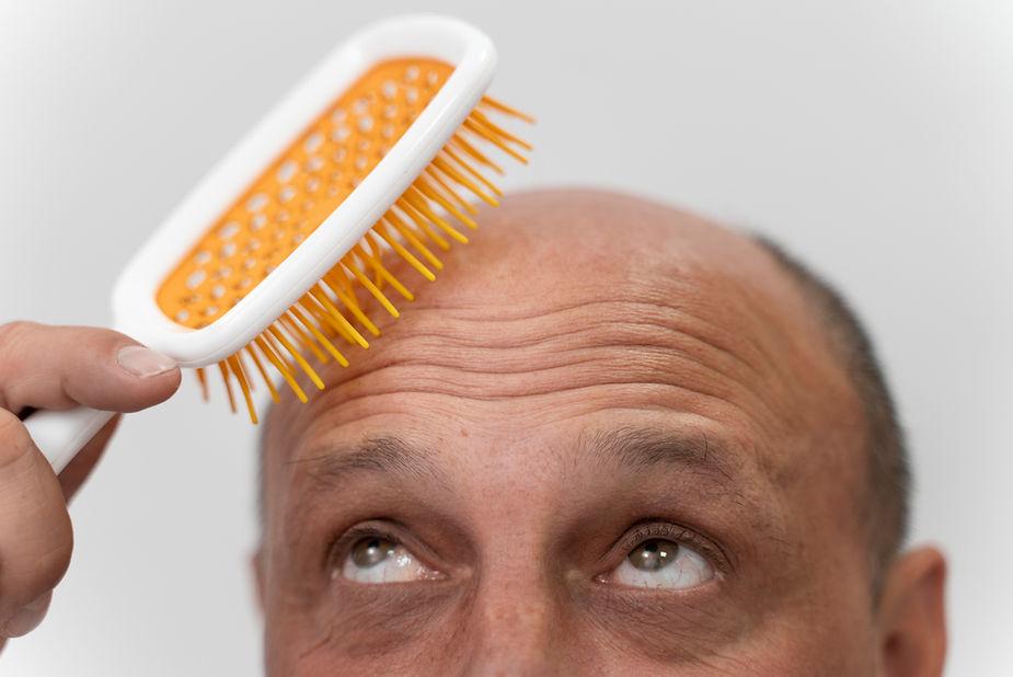 A man holding a comb on a bald head