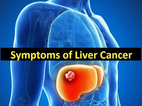 Image result for Symptoms of Liver Cancer