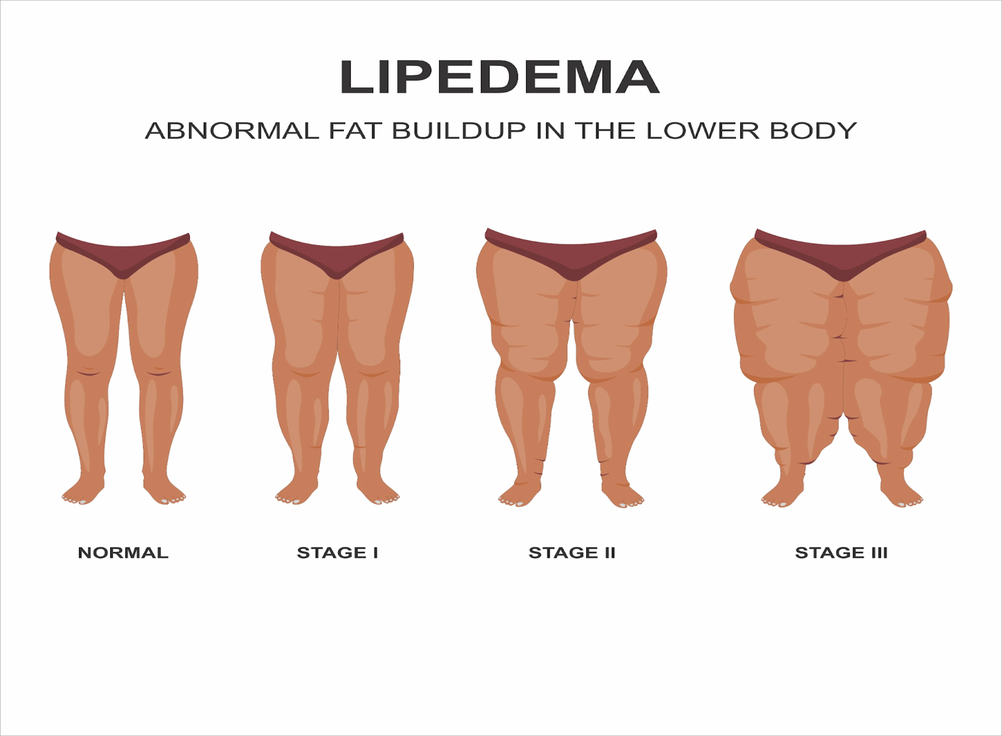 A comparison of different types of fats

Description automatically generated