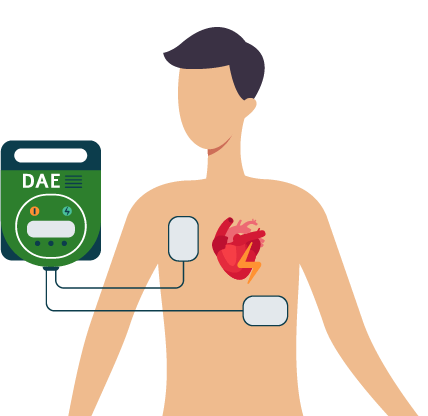 Illustration d'un défibrillateur automatique externe pour les gestes de premiers secours en entreprise