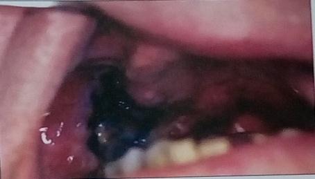 Exámenes biológicos en odontología