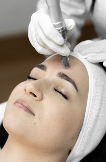 microneedling facial