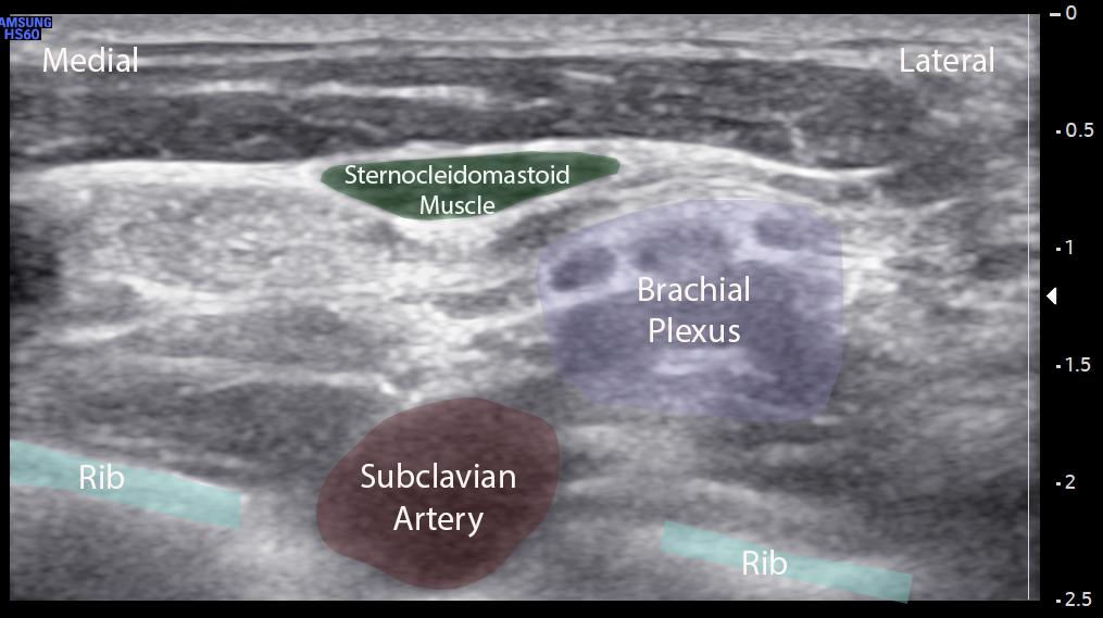 A medical image of a ultrasound

Description automatically generated with medium confidence