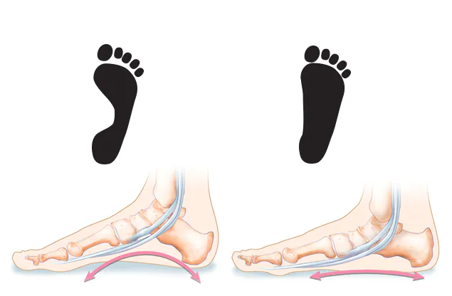 A diagram of a foot and foot bonesDescription automatically generated