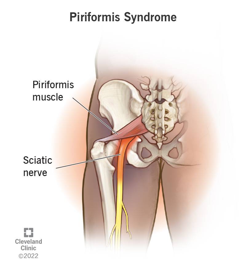 posterior view of piriformis and sciatic nerve
