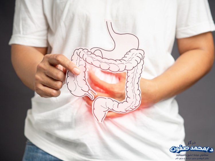 مدة الشفاء من عملية البواسير بالليزر