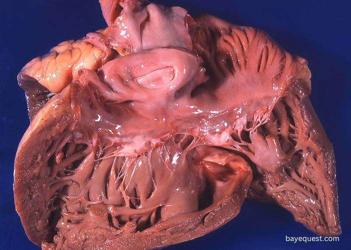 Horse Heart Abnormalities