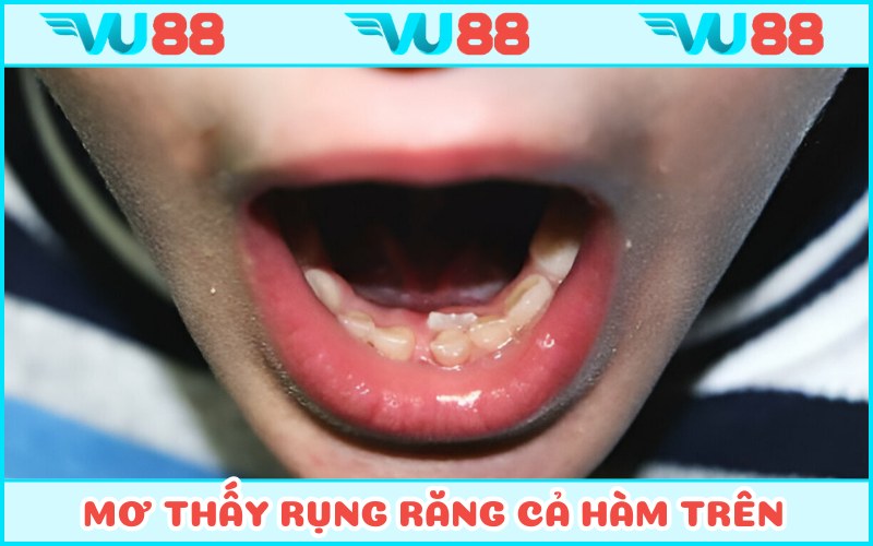Chiêm bao rụng tất cả hàm trên