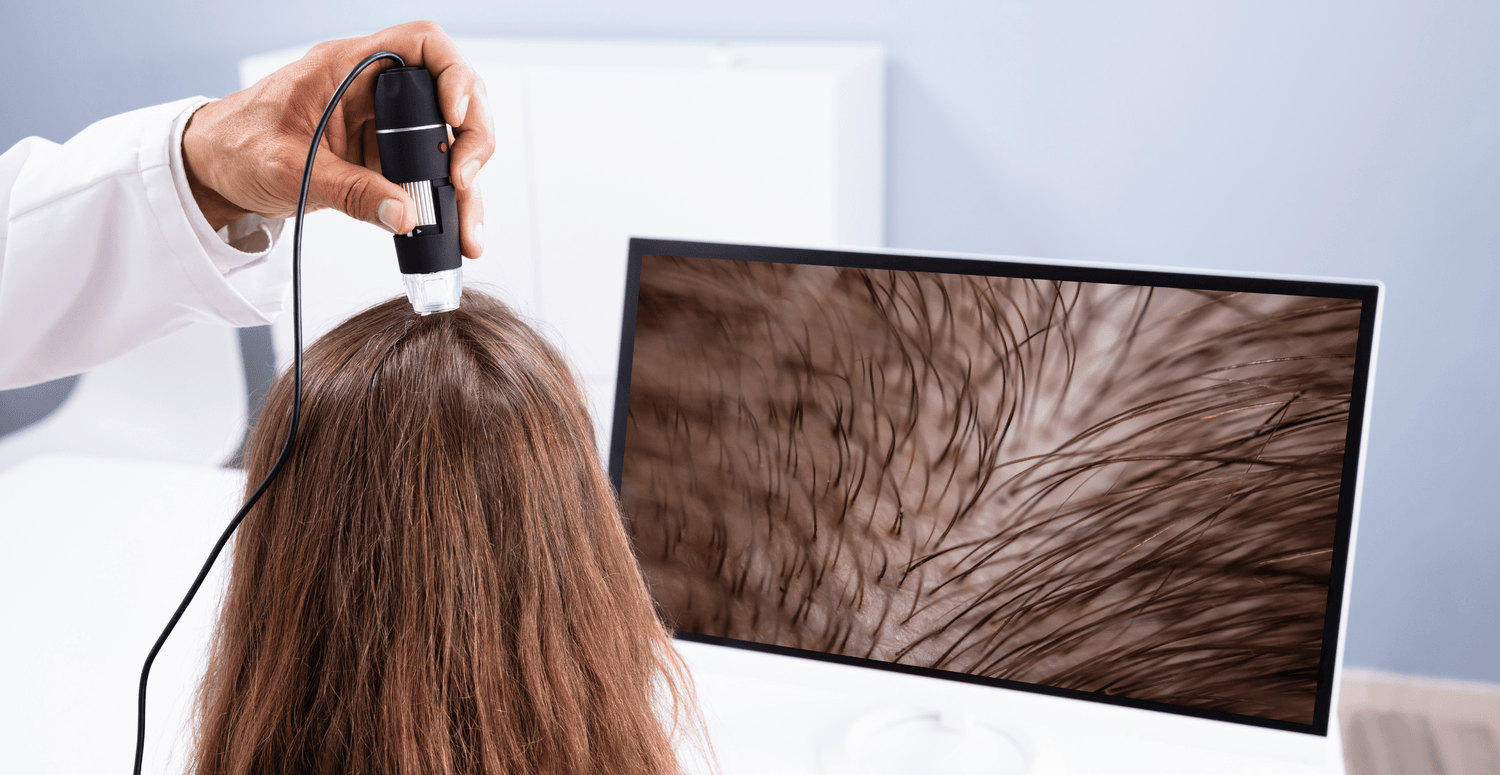 in this image the hair specialist diagnose the root cause of hair fall at Renew You clinic by https://renewyou.co.in/