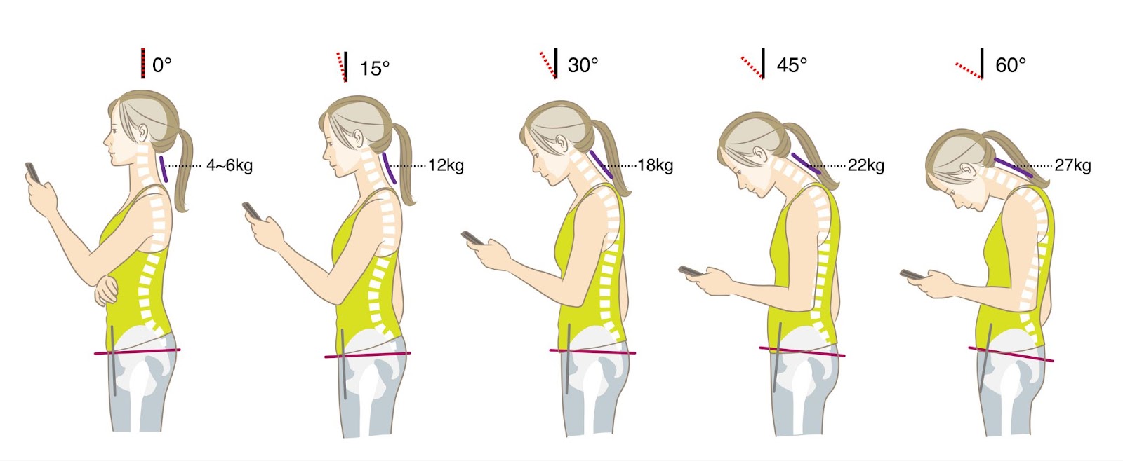 Diverse tipologie di posture durante l'utilizzo dello smartphone