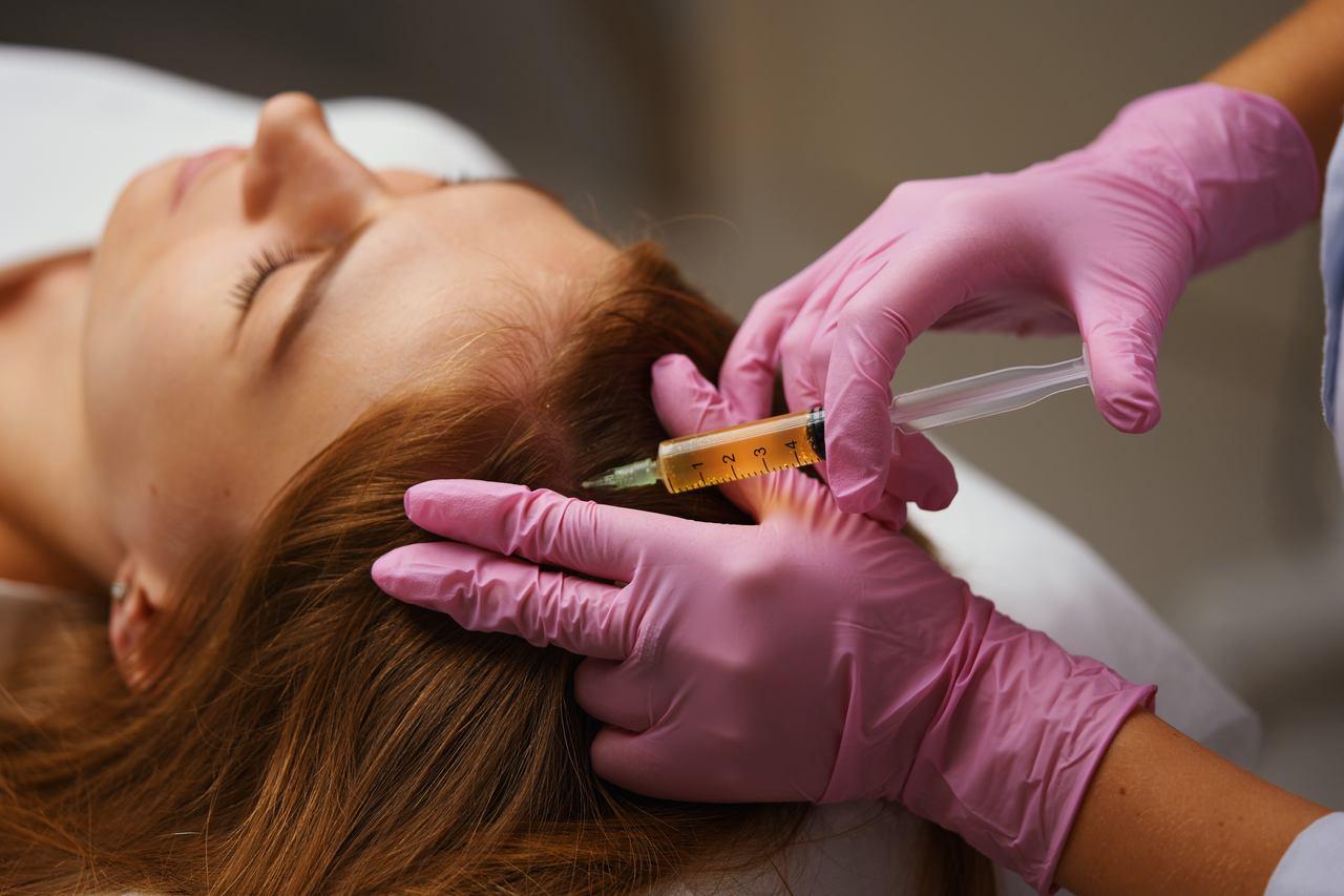 PRP (plasma rico em plaquetas) – Dra. Lorena Ávila Médica Dermatologista  Goiânia, Especialista em Doenças do Cabelo e Couro Cabeludo em Goiânia,  Dermatologista em Goiânia, Dermatologia Goiânia, Dermatologista  Especialista em Tricologia em