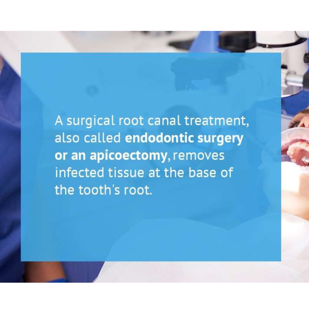 surgical vs non-surgical root canal
