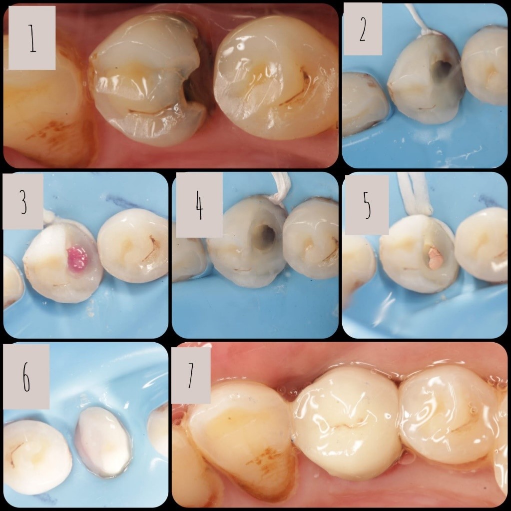 A collage of teeth
Description automatically generated