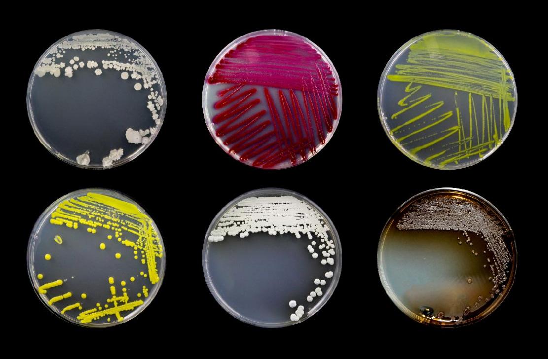 A picture of 6 petri dishes containing different naturally occuring microbes to control agricultural pests.