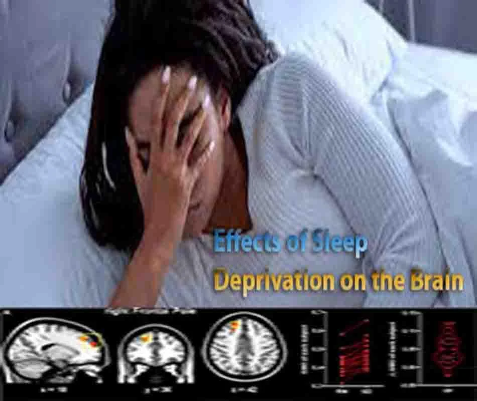 Sleep Deprivation: How actually effects Brain and Body Quickly