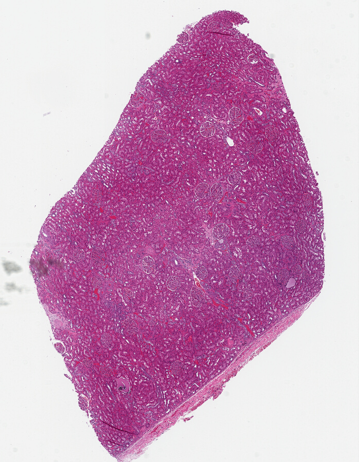 Renal tissue from the TCGA with obvious glomeruli and tubules