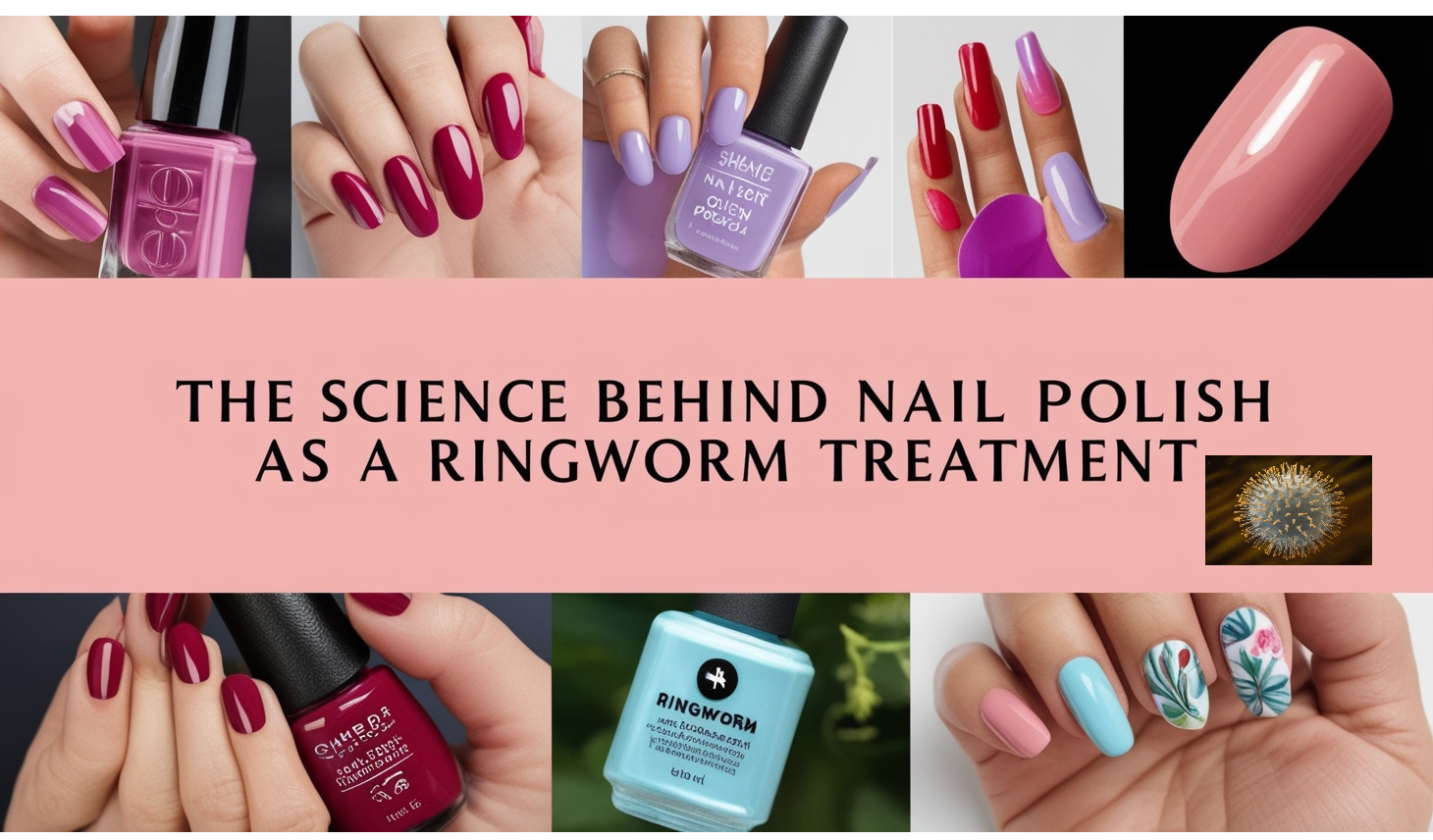 The Science Behind Nail Polish as a Ringworm Treatment