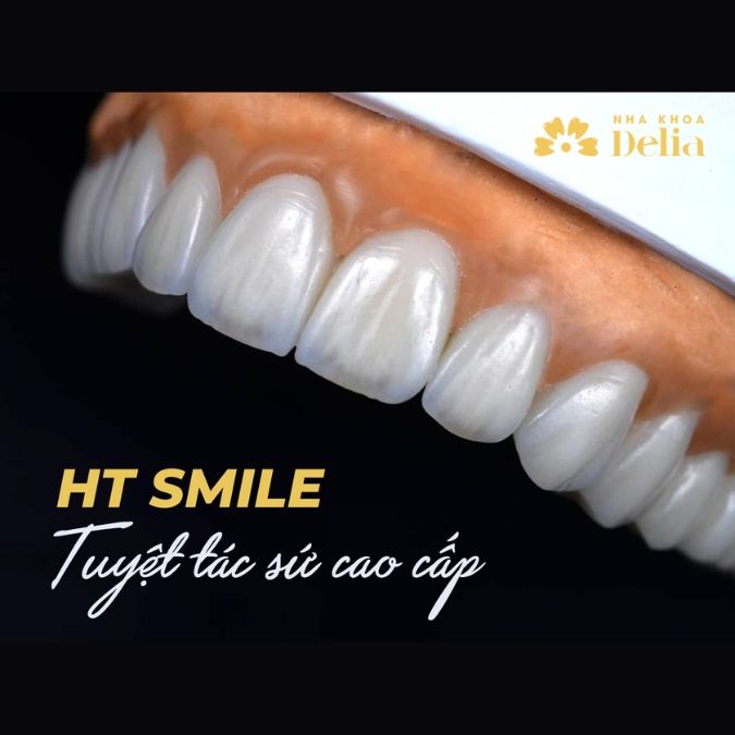 Răng sứ HT Smile là gì? Răng sứ HT Smile có xuất xứ từ đâu?