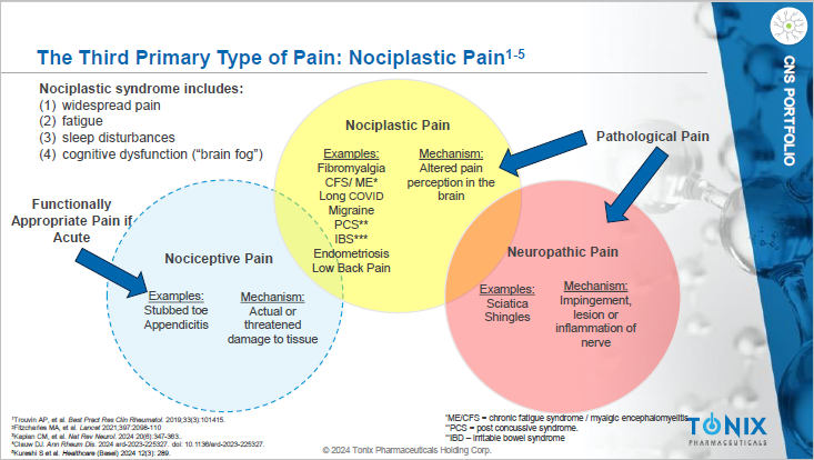 A diagram of pain in a group

Description automatically generated