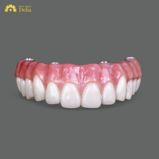 Phân loại răng sứ Zirconia theo chức năng