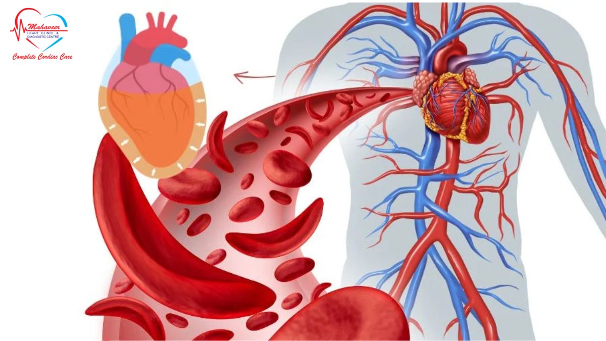 Pericardial-Effusion- Dr Rakesh Jain - Best Cardiologist