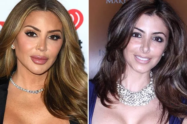 Larsa Pippen Before and After Plastic Surgery