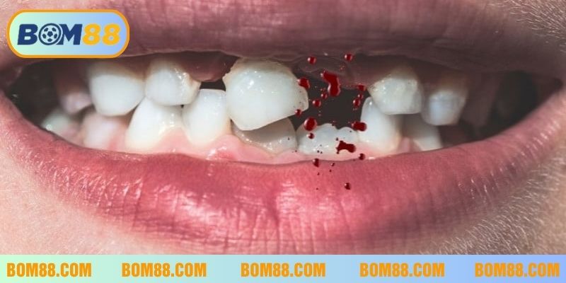 Đánh con gì khi nằm mơ thấy bị mất răng