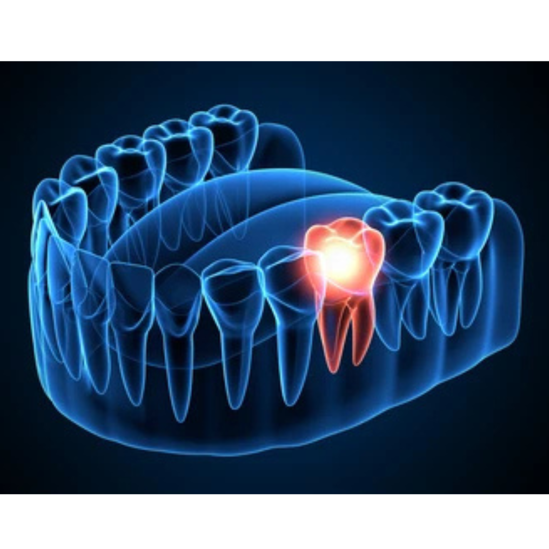 Effective Solutions for Toothache Pulsing