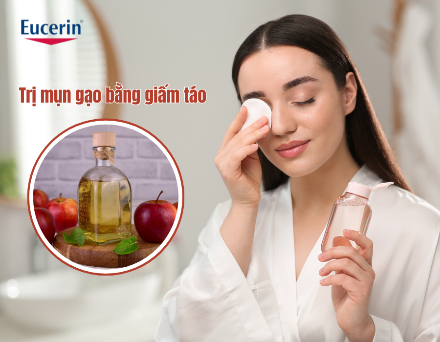 Trị mụn gạo bằng giấm táo