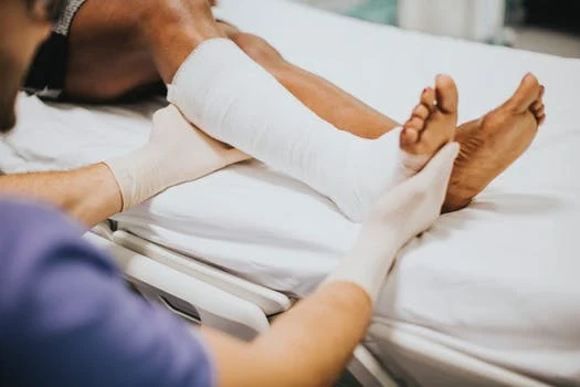 a patient with broken leg on a hospital bed