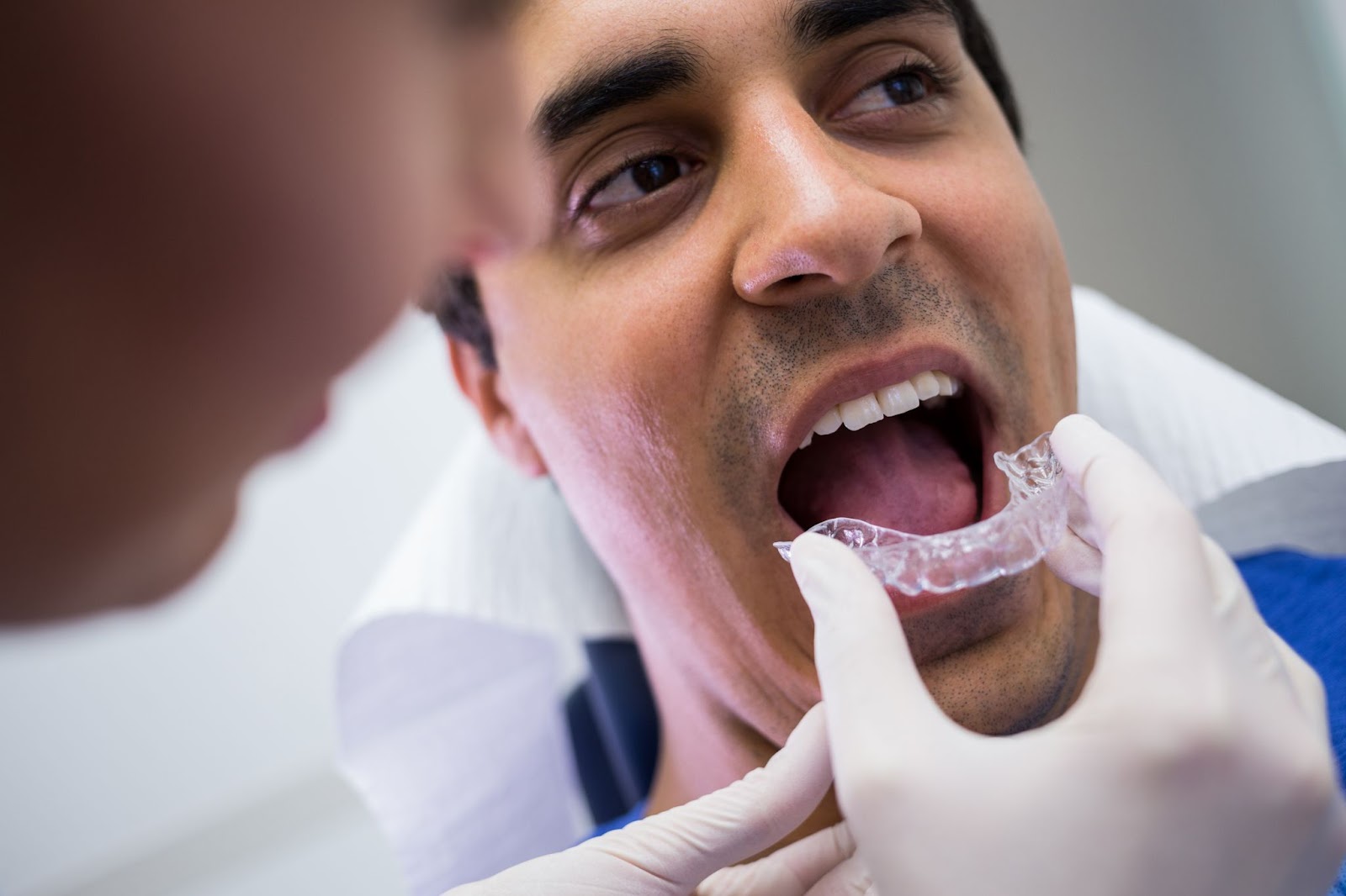 Dentist fitting a custom mouthguard for a male patient to prevent teeth grinding (bruxism).
