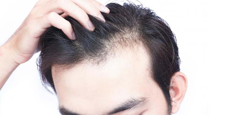 hair loss treatment