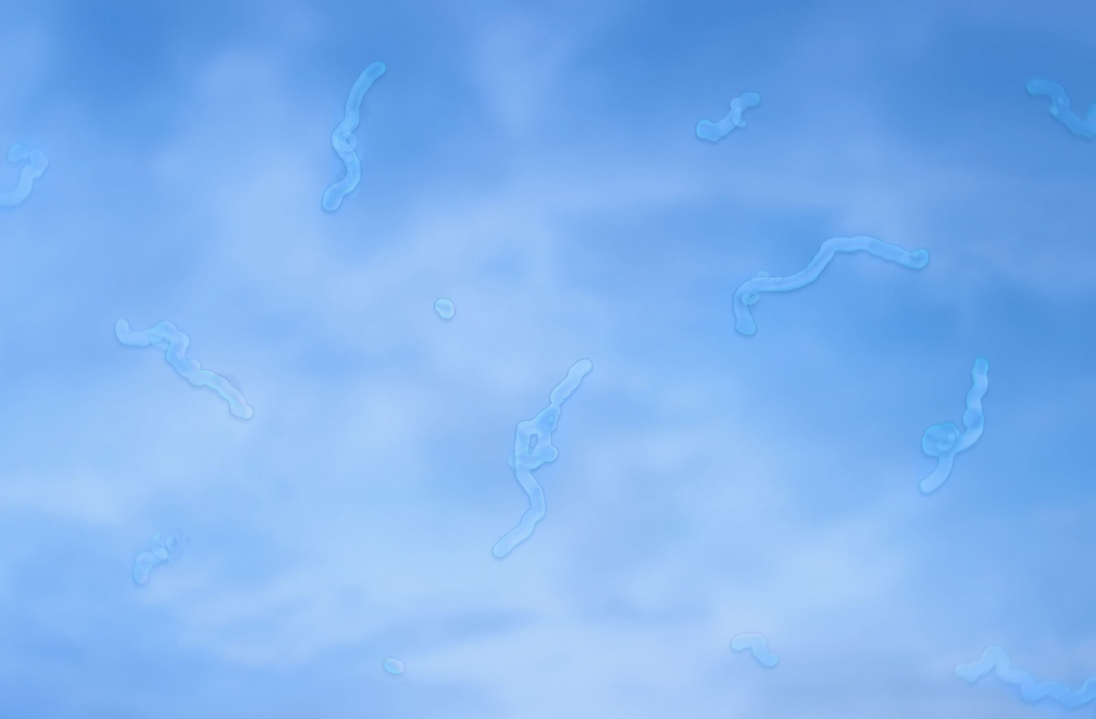 An example of eye floaters against a blue sky.