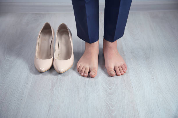 Rester sexy avec un hallux valgus