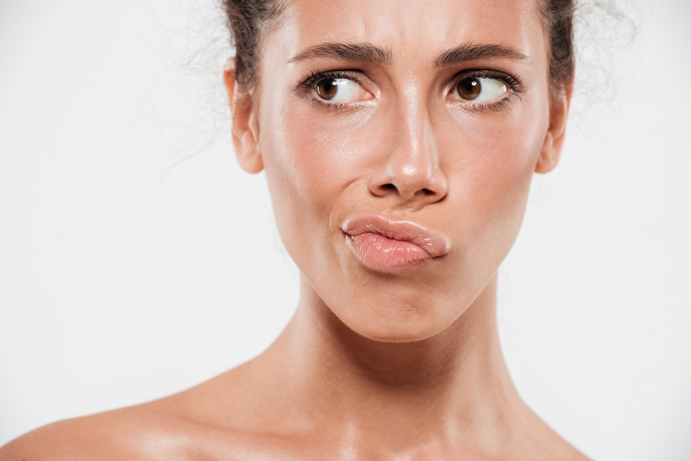 lip filler migration