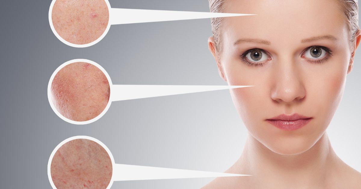 Types of Skin Care Creams